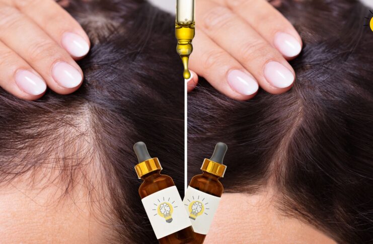 Top 5 Hair Regrowth Serums for Women: What to Buy in 2025 | Brain Of Interest